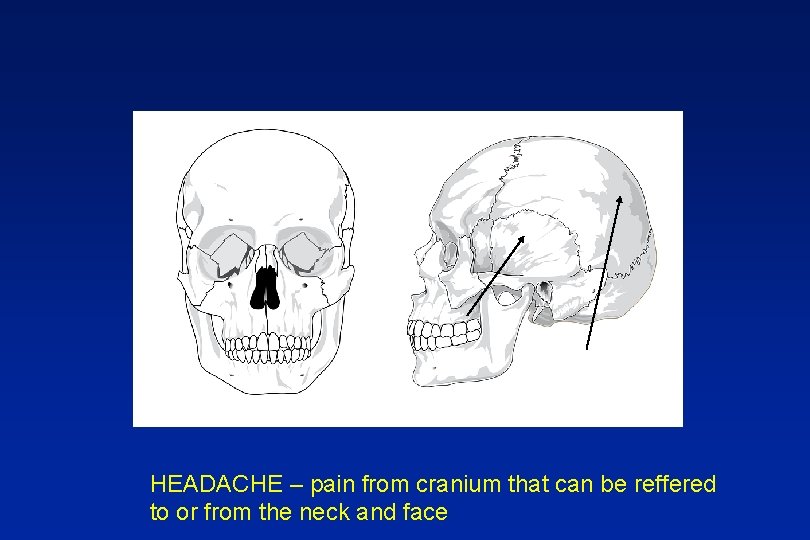HEADACHE – pain from cranium that can be reffered to or from the neck