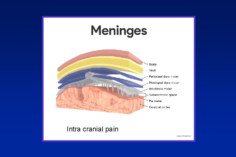 Intra cranial pain 