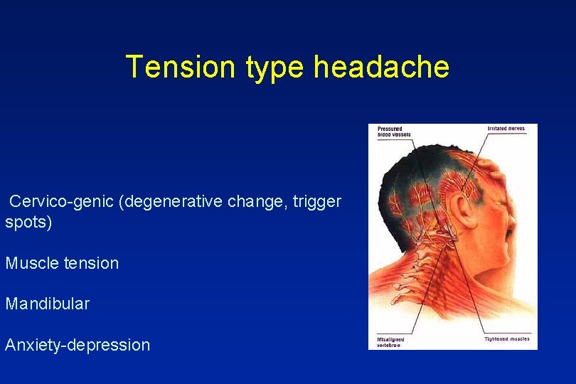 Tension type headache Cervico-genic (degenerative change, trigger spots) Muscle tension Mandibular Anxiety-depression 