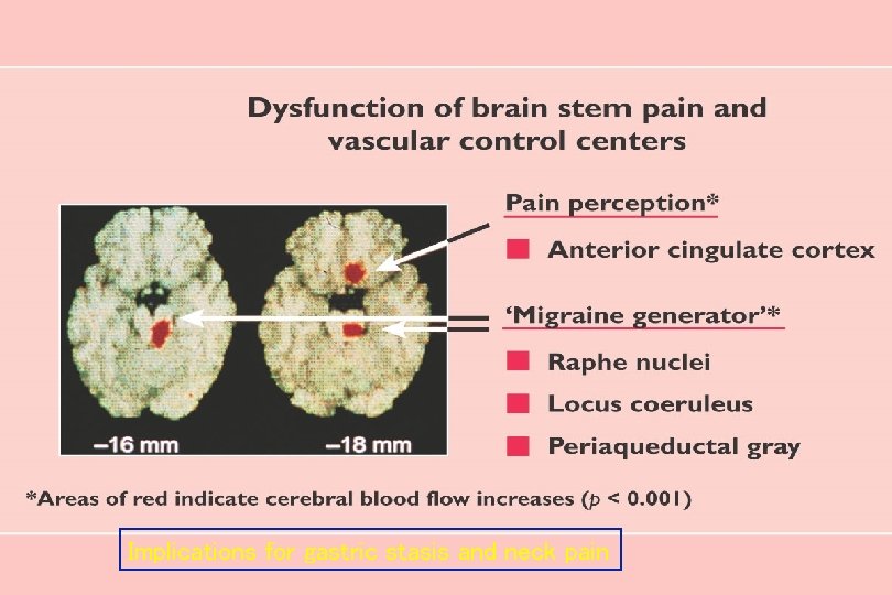 Implications for gastric stasis and neck pain 