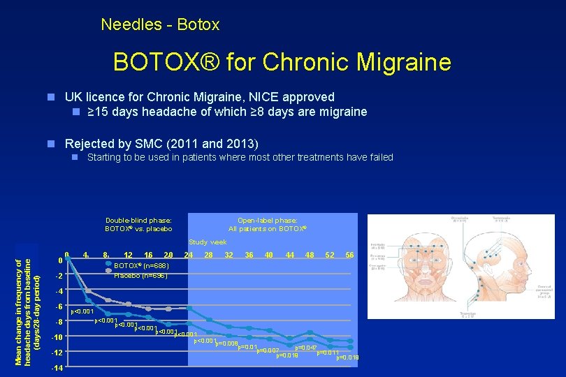 Needles - Botox BOTOX® for Chronic Migraine n UK licence for Chronic Migraine, NICE