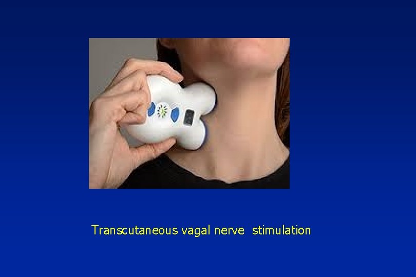 Transcutaneous vagal nerve stimulation 