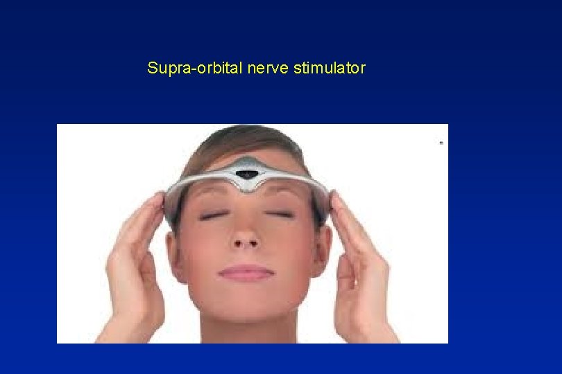 Supra-orbital nerve stimulator 