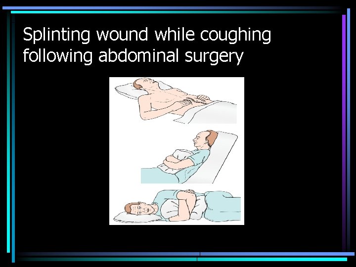 Splinting wound while coughing following abdominal surgery 