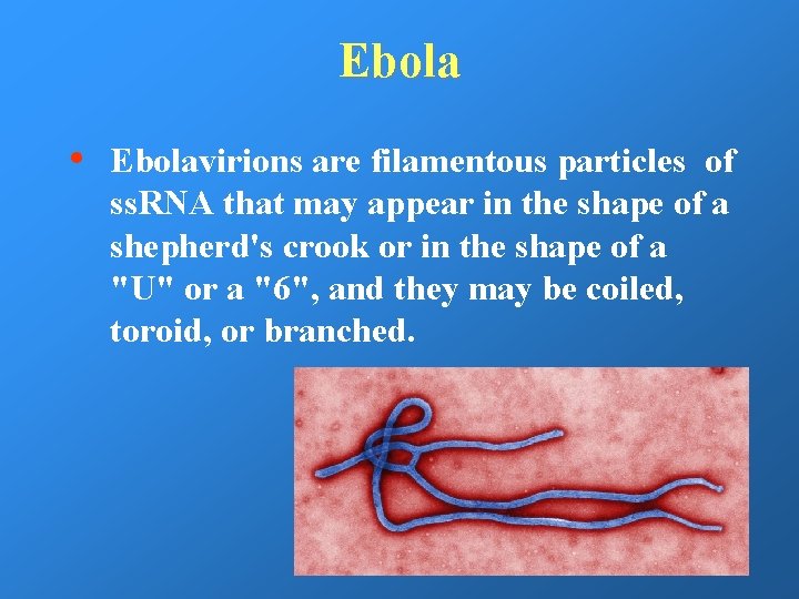 Ebola • Ebolavirions are filamentous particles of ss. RNA that may appear in the