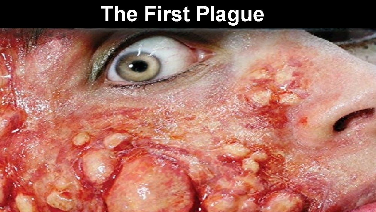 The First Plague 