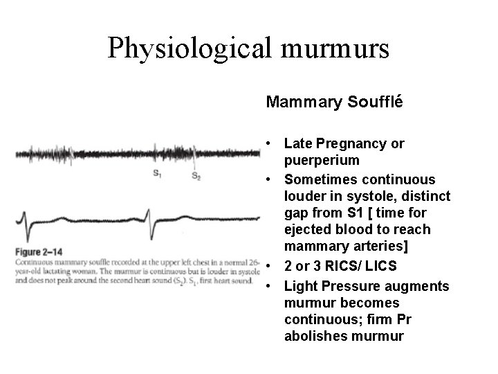 Physiological murmurs Mammary Soufflé • Late Pregnancy or puerperium • Sometimes continuous louder in