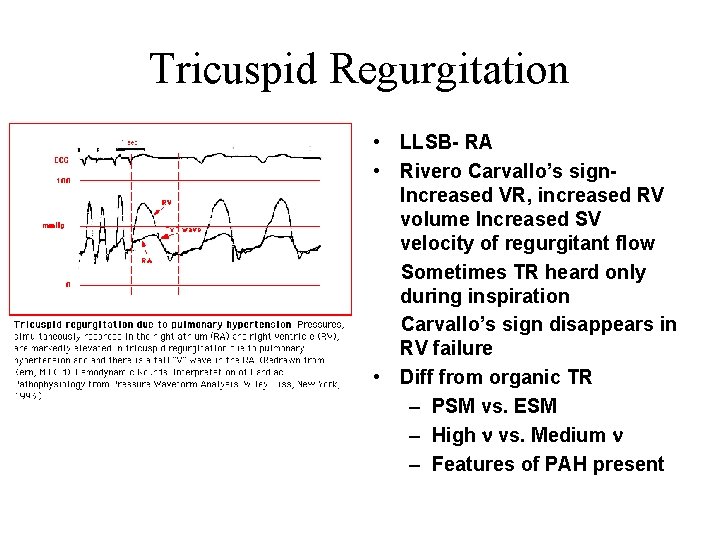 Tricuspid Regurgitation • LLSB- RA • Rivero Carvallo’s sign. Increased VR, increased RV volume