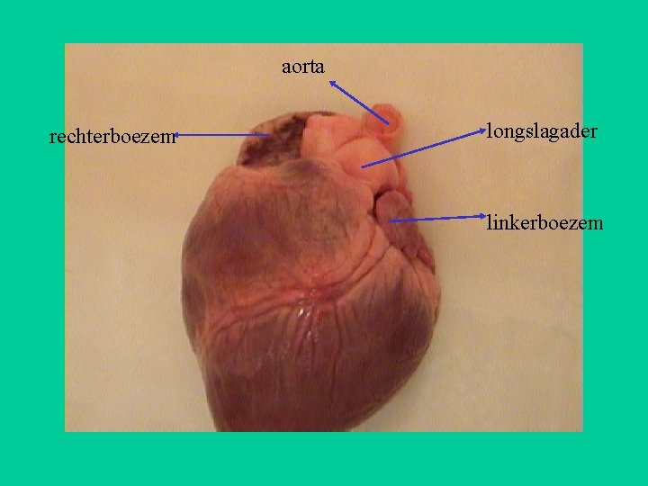 aorta rechterboezem longslagader linkerboezem 