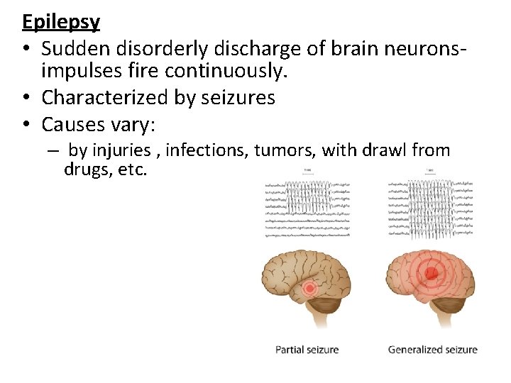 Epilepsy • Sudden disorderly discharge of brain neuronsimpulses fire continuously. • Characterized by seizures