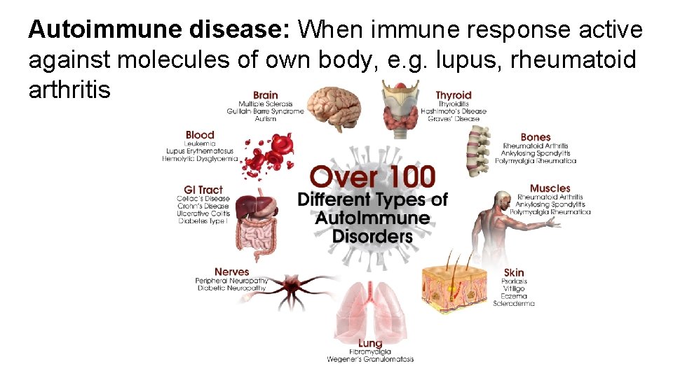 Autoimmune disease: When immune response active against molecules of own body, e. g. lupus,