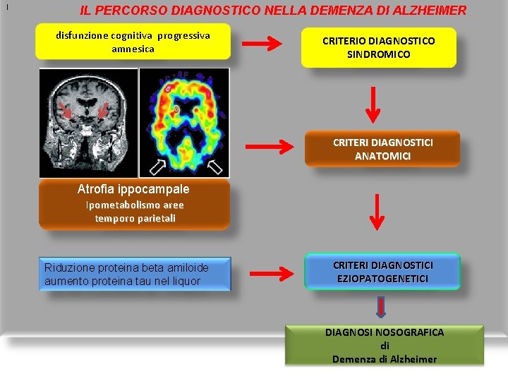 [ IL PERCORSO DIAGNOSTICO NELLA DEMENZA DI ALZHEIMER disfunzione cognitiva progressiva amnesica CRITERIO DIAGNOSTICO