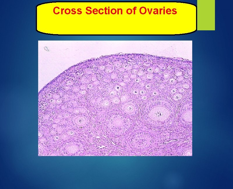 Cross Section of Ovaries 