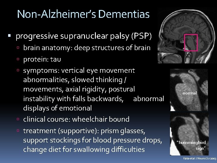 Non-Alzheimer’s Dementias progressive supranuclear palsy (PSP) brain anatomy: deep structures of brain protein: tau Non-Alzheimer’s Dementias progressive supranuclear palsy (PSP) brain anatomy: deep structures of brain protein: tau