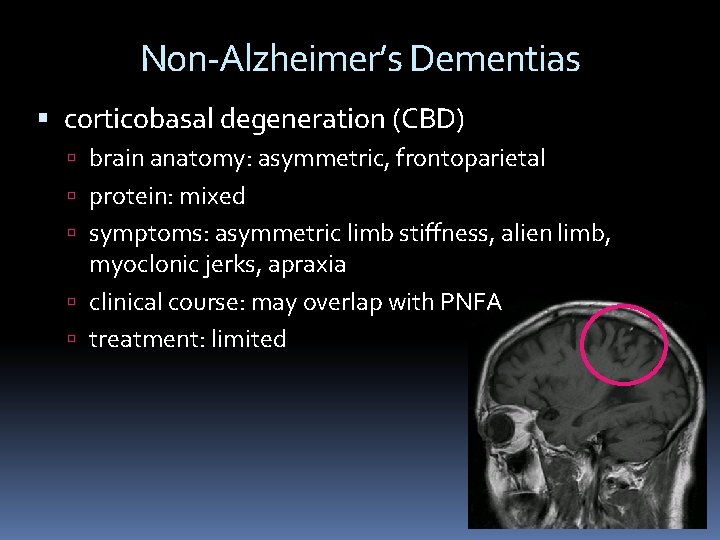 Non-Alzheimer’s Dementias corticobasal degeneration (CBD) brain anatomy: asymmetric, frontoparietal protein: mixed symptoms: asymmetric limb Non-Alzheimer’s Dementias corticobasal degeneration (CBD) brain anatomy: asymmetric, frontoparietal protein: mixed symptoms: asymmetric limb