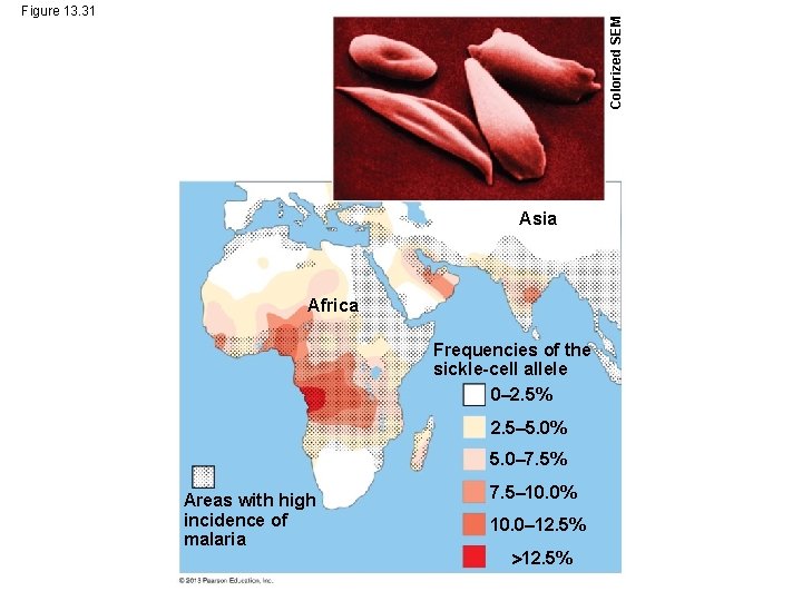 Colorized SEM Figure 13. 31 Asia Africa Frequencies of the sickle-cell allele 0– 2.