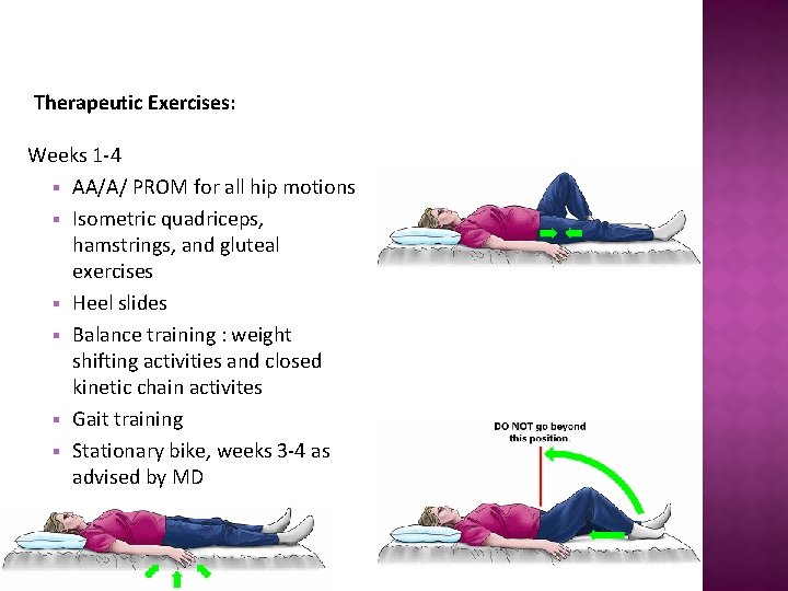 Therapeutic Exercises: Weeks 1 -4 § AA/A/ PROM for all hip motions § Isometric