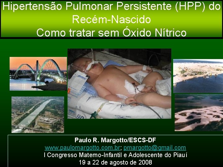 Hipertensão Pulmonar Persistente (HPP) do Recém-Nascido Como tratar sem Óxido Nítrico Paulo R. Margotto/ESCS-DF
