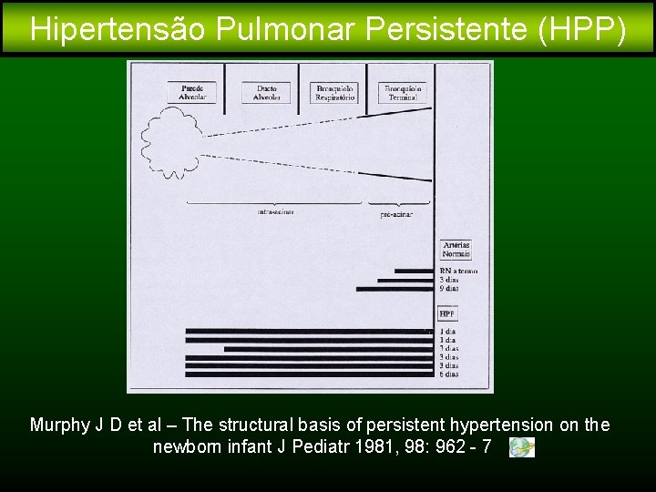 Hipertensão Pulmonar Persistente (HPP) Murphy J D et al – The structural basis of