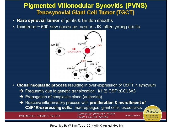 Pigmented Villonodular Synovitis (PVNS) Tenosynovial Giant Cell Tumor (TGCT) Presented By William Tap at