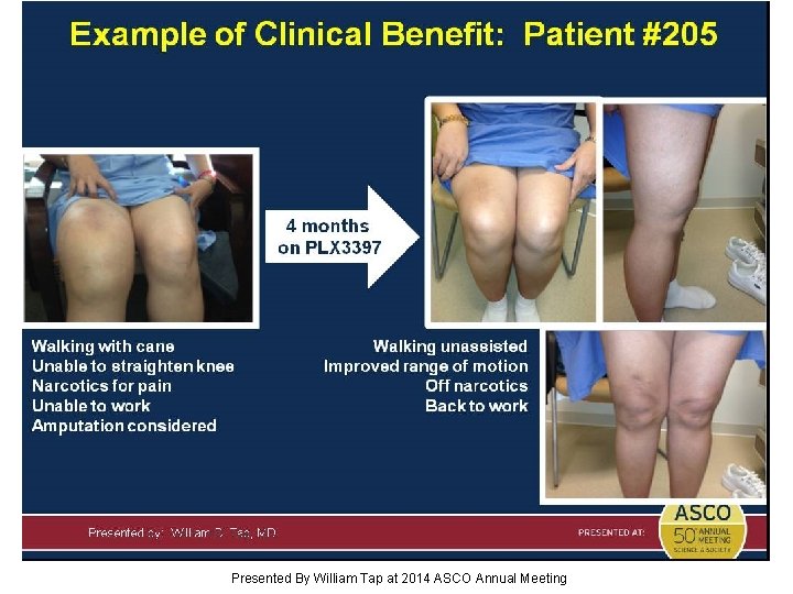 Slide 21 Presented By William Tap at 2014 ASCO Annual Meeting 