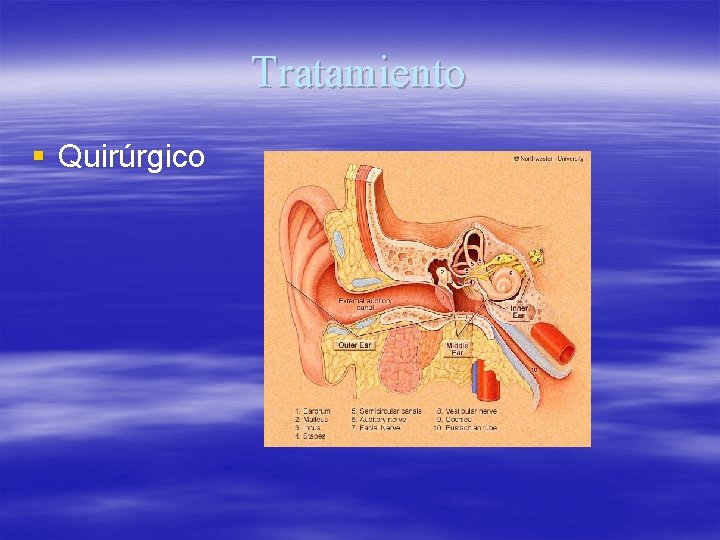 Tratamiento § Quirúrgico 