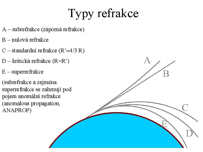 Typy refrakce A – subrefrakce (záporná refrakce) B – nulová refrakce C – standardní