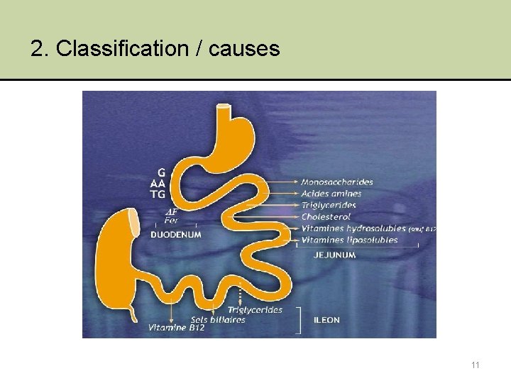 2. Classification / causes 11 