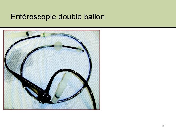 Entéroscopie double ballon 69 