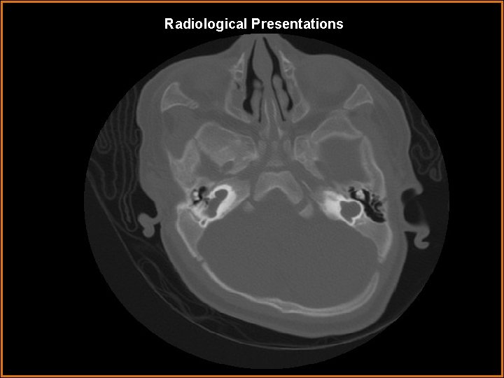 Radiological Presentations 