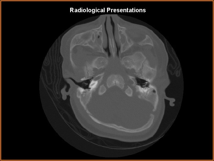 Radiological Presentations 