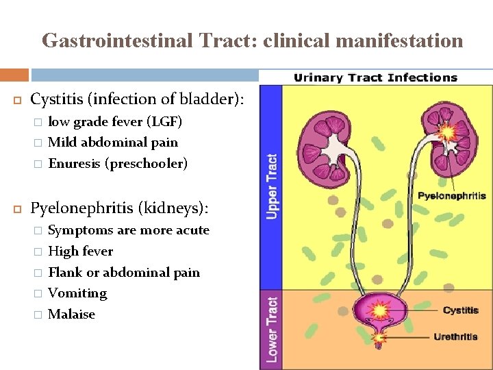 Gastrointestinal Tract: clinical manifestation Cystitis (infection of bladder): � � � low grade fever