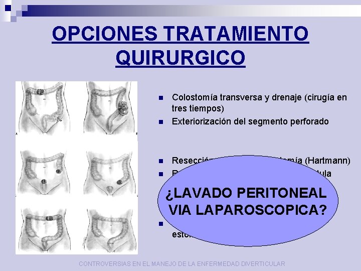 OPCIONES TRATAMIENTO QUIRURGICO n n Colostomía transversa y drenaje (cirugía en tres tiempos) Exteriorización