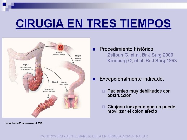 CIRUGIA EN TRES TIEMPOS n Procedimiento histórico Zeitoun G, et al. Br J Surg