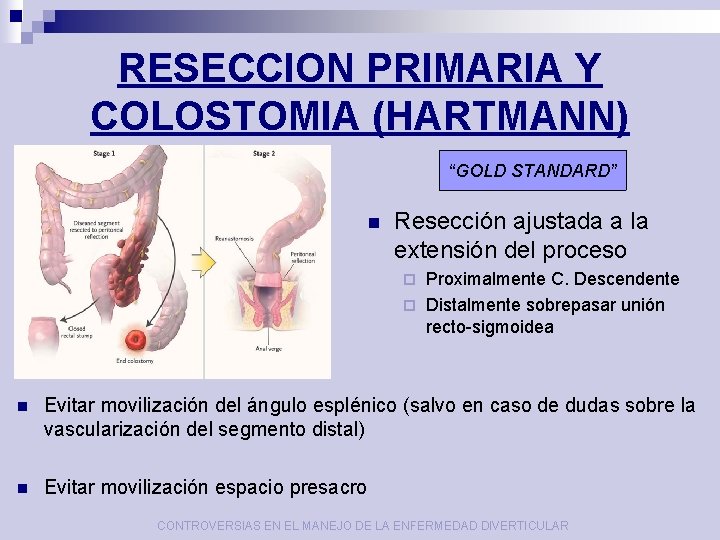 RESECCION PRIMARIA Y COLOSTOMIA (HARTMANN) “GOLD STANDARD” n Resección ajustada a la extensión del