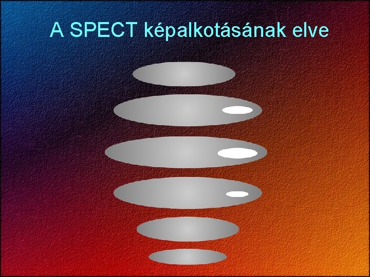 A SPECT képalkotásának elve 