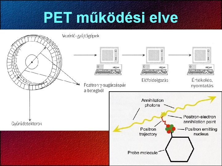 PET működési elve 