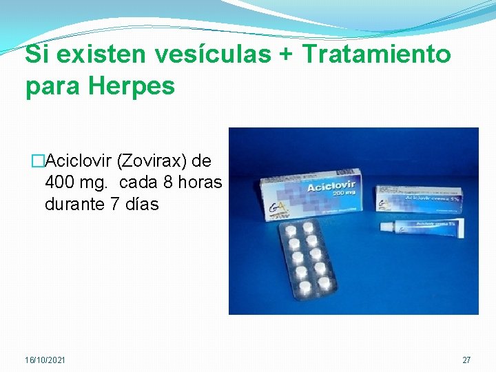 Si existen vesículas + Tratamiento para Herpes �Aciclovir (Zovirax) de 400 mg. cada 8