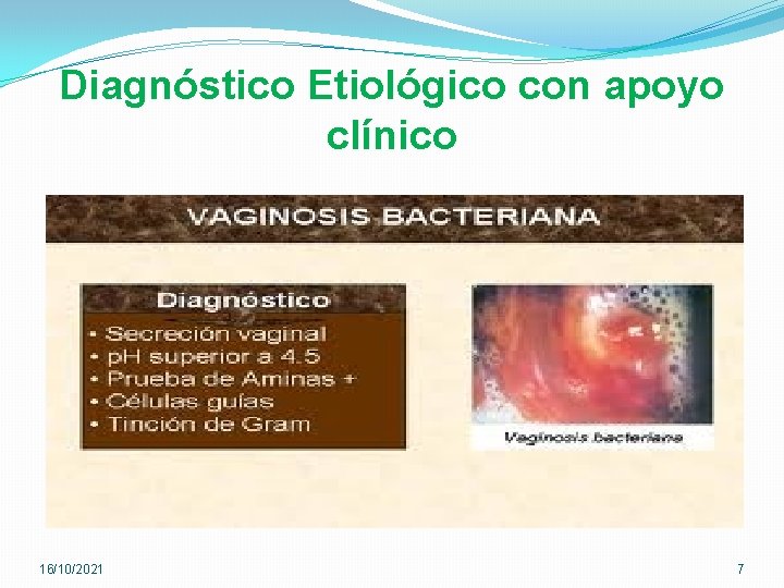 Diagnóstico Etiológico con apoyo clínico 16/10/2021 7 