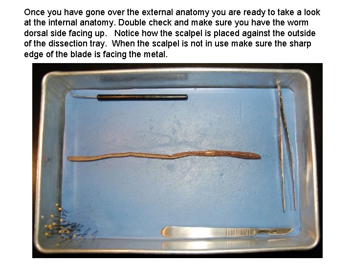 Once you have gone over the external anatomy you are ready to take a