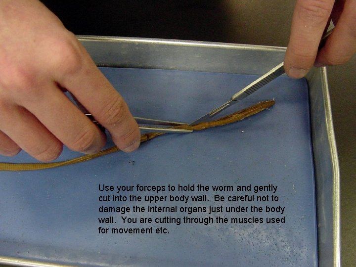 Place image of starting the proceedure Use your forceps to hold the worm and