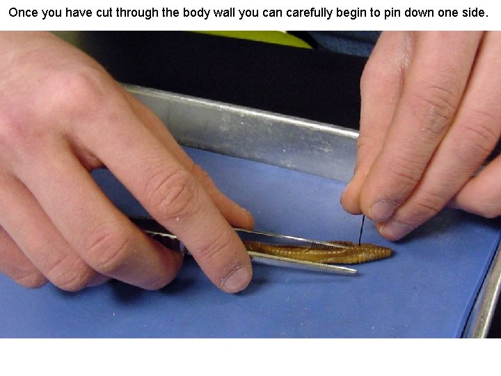 Once you have cut through the body wall you can carefully begin to pin