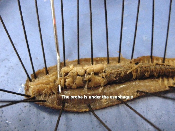 The probe is under the esophagus 