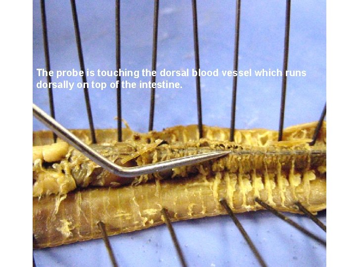 The probe is touching the dorsal blood vessel which runs dorsally on top of
