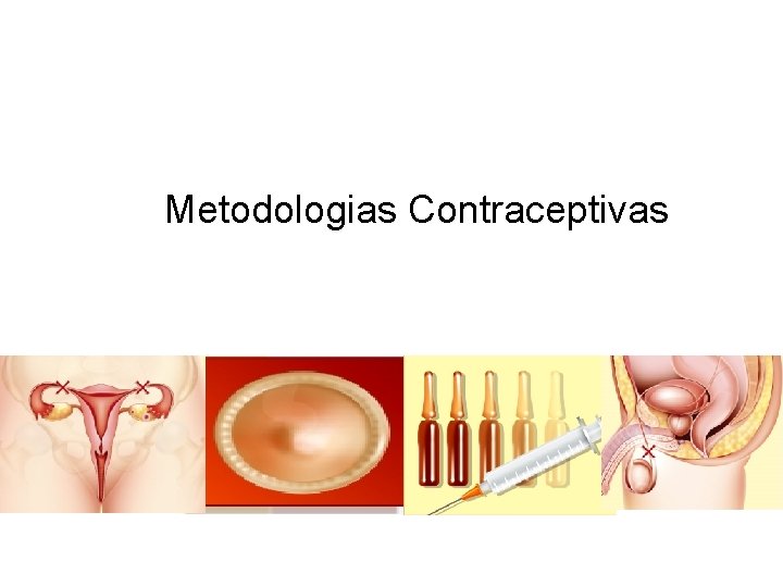 Metodologias Contraceptivas 