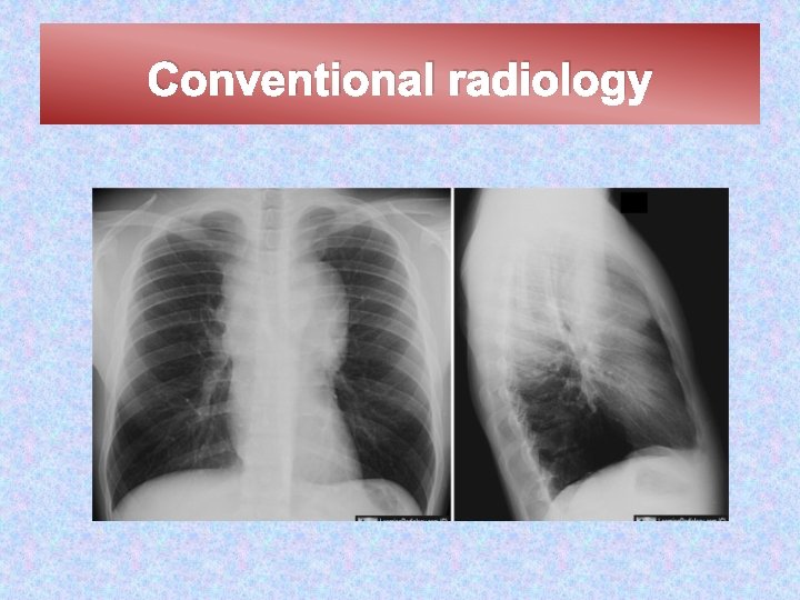 Conventional radiology 
