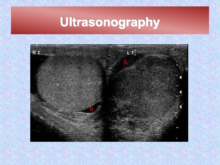 Ultrasonography 