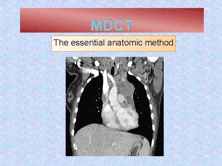 MDCT The essential anatomic method 