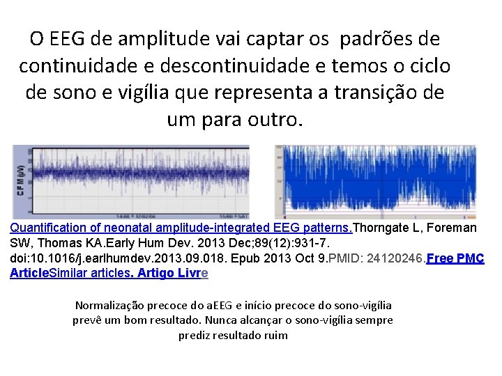 O EEG de amplitude vai captar os padrões de continuidade e descontinuidade e temos