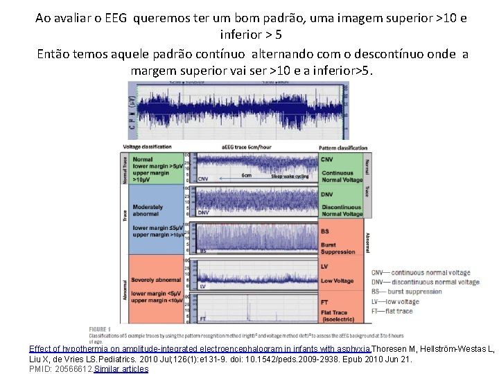 Ao avaliar o EEG queremos ter um bom padrão, uma imagem superior >10 e